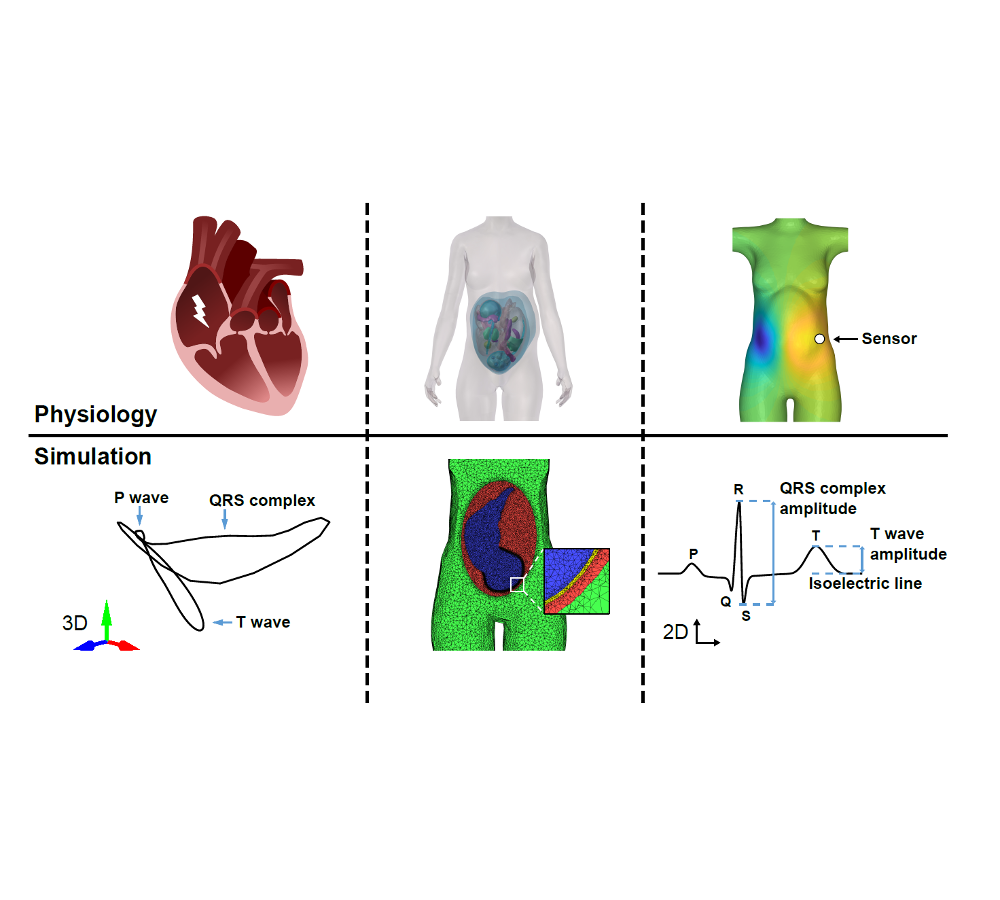 The influence of vectorcardiogram orientation on the T/QRS ratio obtained via non-invasive fetal ECG